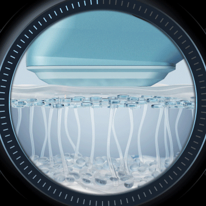 HIFU treatment program animation